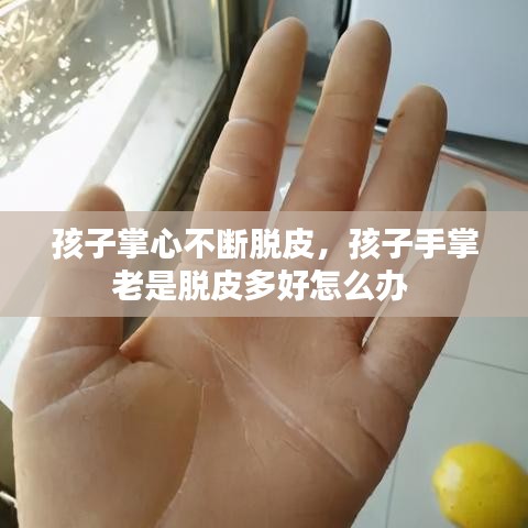 孩子掌心不断脱皮,孩子手掌老是脱皮多好怎么办
