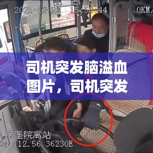 司机突发脑溢血图片，司机突发脑出血雇主有责任吗?走法律我要陪多少钱 